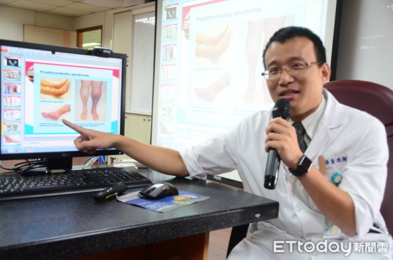 下肢深層靜脈栓塞　引發要命肺栓塞