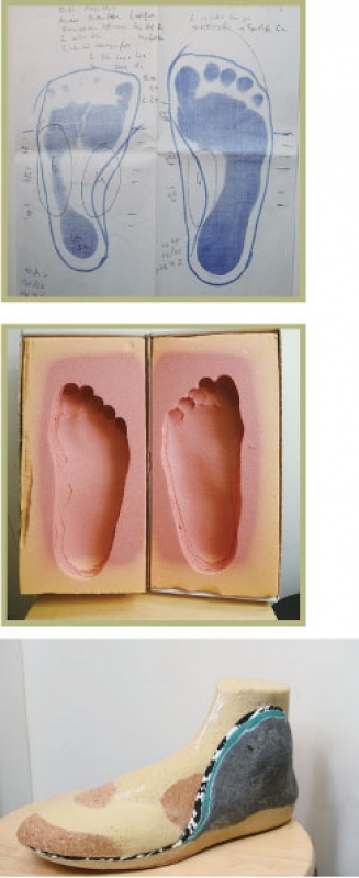 套取足模、量度數據外，還需要仔細記錄腳部皮膚、關節觸感柔軟度等細節