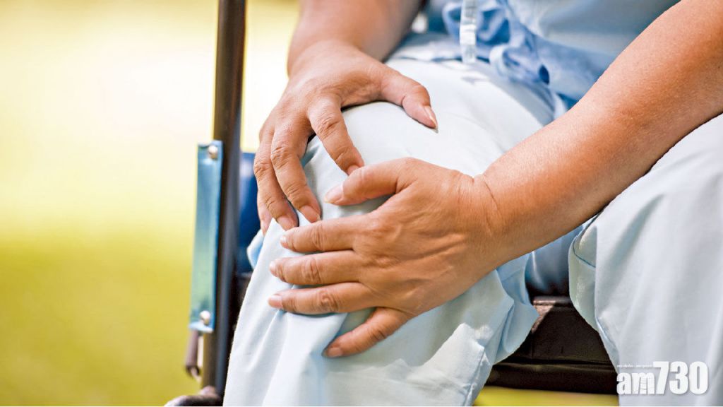 類風濕性關節炎破壞關節 嚴重或須輪椅代步