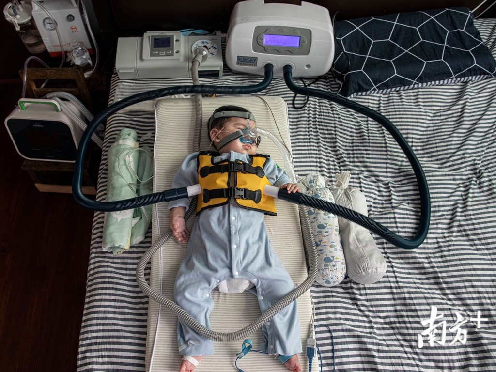 「米粒」身上有很多儀器。