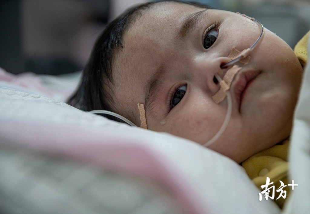 10個月大「米粒」患有脊髓性肌肉萎縮症。