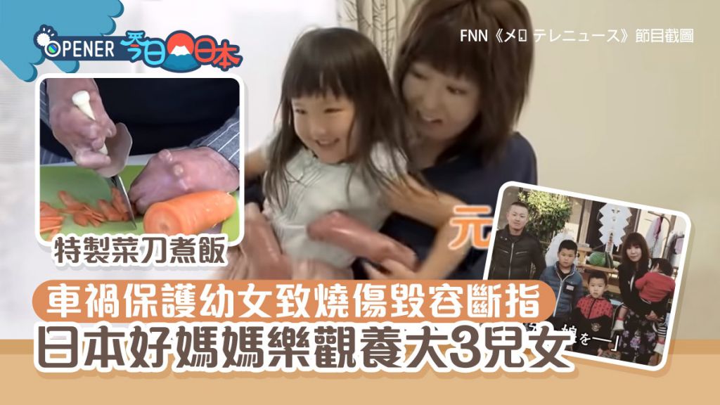 日本好媽媽保護幼女致燒傷毀容斷指　克服傷殘養大3兒女感動全國