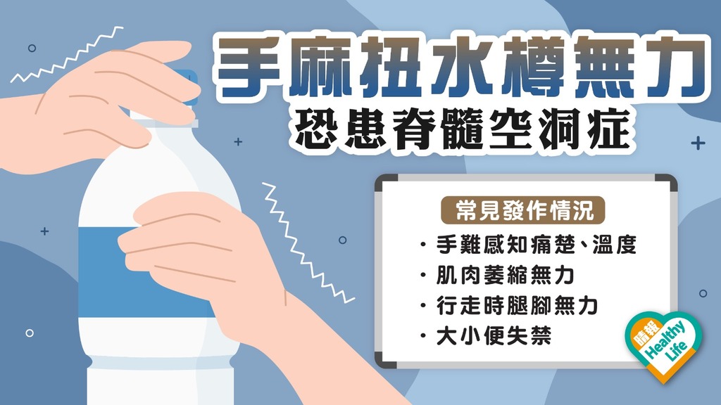 罕見病 │ 手部麻木扭水樽都無力 恐患脊髓空洞症 嚴重可致失禁