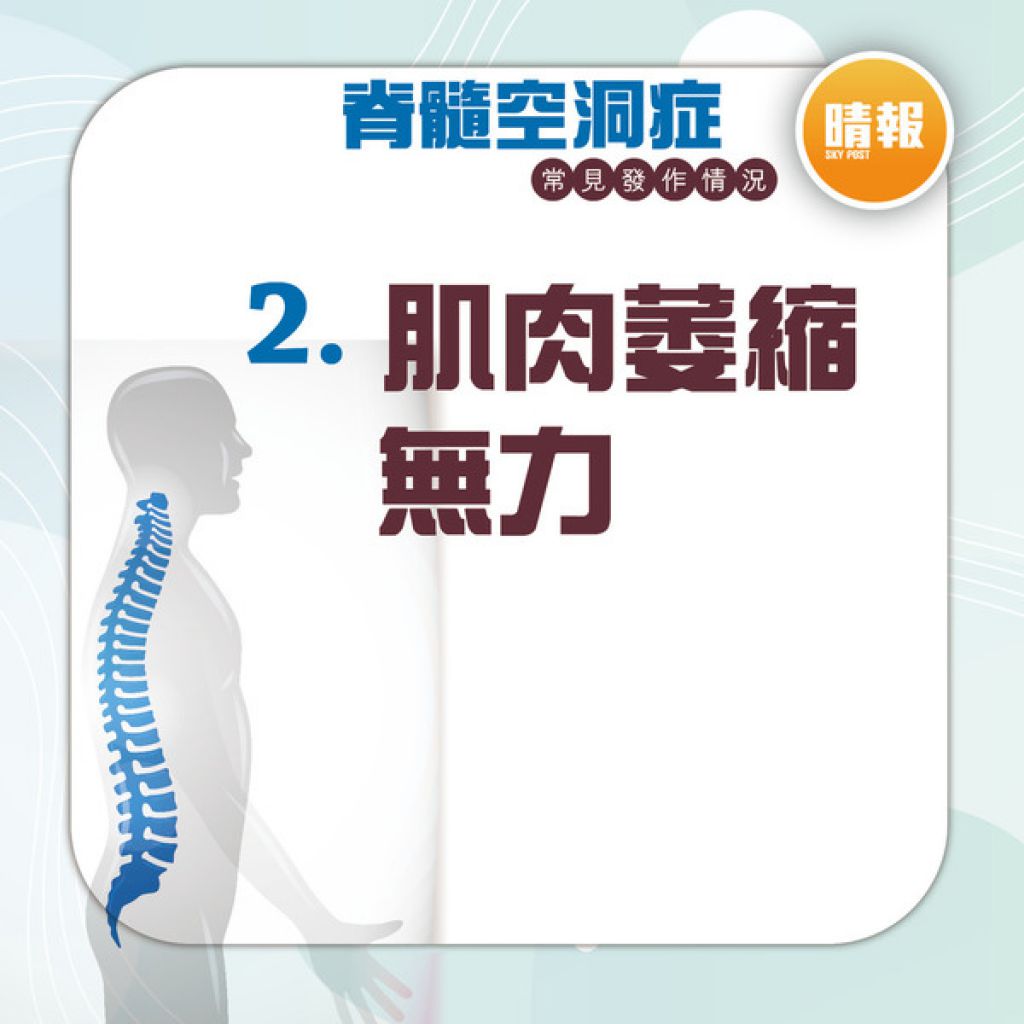 罕見病 │ 手部麻木扭水樽都無力 恐患脊髓空洞症 嚴重可致失禁