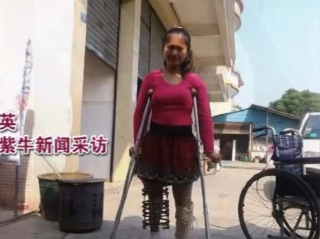 Liang Zhengying suffered from osteogenesis imperfecta since childhood.