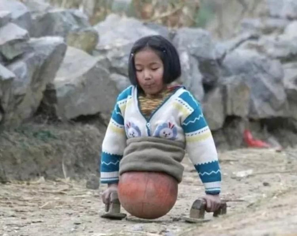 錢紅艷小時候被拍攝到用籃球走路而成名。
