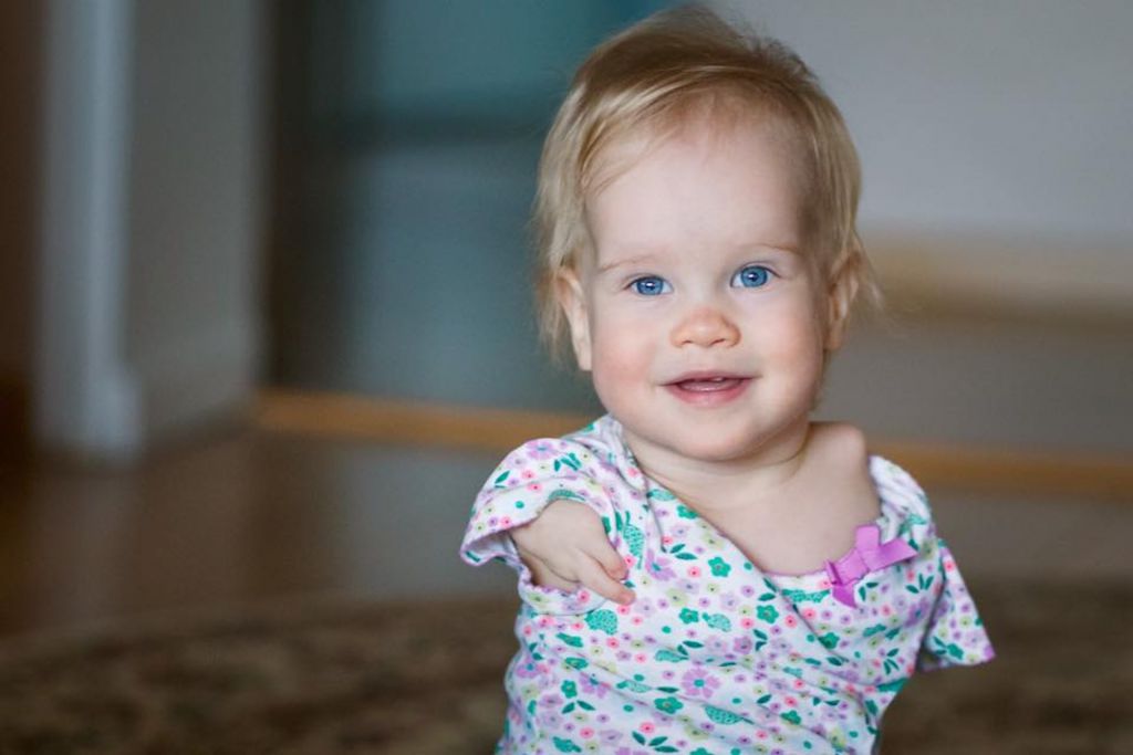 美國一名女嬰Vasilina天生失去雙臂，因此一出生就慘被親生父母拋棄。